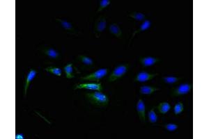 Immunofluorescent analysis of Hela cells using ABIN7143395 at dilution of 1:100 and Alexa Fluor 488-congugated AffiniPure Goat Anti-Rabbit IgG(H+L) (ELTD1 antibody  (AA 85-299))