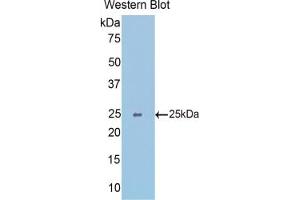 Western blot analysis of the recombinant protein. (SLIT1 antibody  (AA 3-211))