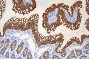IHC analysis of Krt20 using anti-Krt20 antibody (ABIN7601133). (KRT20 antibody  (AA 29-431))