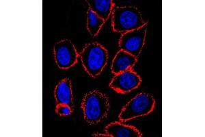 CD44 antibody (ABIN659120 and ABIN2843760) confocal immunofluorescent analysis with hela cell. (CD44 antibody)