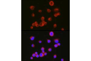 Immunofluorescence analysis of Neuro-2a cells using [KO Validated] CD171/L1CAM Rabbit pAb (ABIN6131538, ABIN6143053, ABIN6143054 and ABIN7101826) at dilution of 1:150 (40x lens). (L1CAM antibody  (AA 1143-1257))