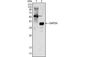 Western blot analysis using MATK antibody against K562 cell lysate (1). (MATK antibody)