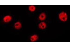 ABIN6275067 staining MCF7 by IF/ICC. (POLI antibody  (N-Term))