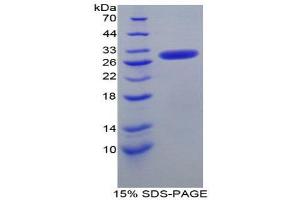 SDS-PAGE (SDS) image for Nucleoporin 50kDa (NUP50) (AA 134-393) protein (His tag) (ABIN1879634) (NUP50 Protein (AA 134-393) (His tag))