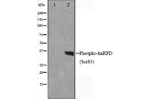 Western blot analysis on HuvEc cell lysate using Phospho-hnRPD(Ser83) Antibody,The lane on the left is treated with the antigen-specific peptide. (HNRNPD/AUF1 antibody  (pSer83))