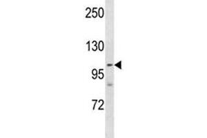 PARP 1 antibody western blot analysis in NCI-H460 lysate. (PARP1 antibody  (AA 590-618))