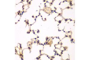 Immunohistochemistry of paraffin-embedded rat lung using NFKBIB antibody (ABIN5973399) at dilution of 1/200 (40x lens).