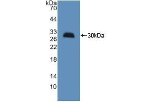 Detection of Recombinant HMGCS, Mouse using Polyclonal Antibody to Hydroxymethylglutaryl Coenzyme A Synthase (HMGCS) (HMGCS1 antibody  (AA 1-238))