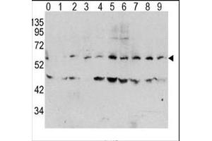 Western blot analysis of phospho c-Myc antibody and human TPA activated HeLa cells/lysate (0: without TPA (c-MYC antibody  (pThr58))