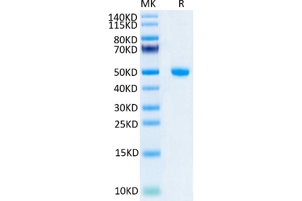 Lipocalin 2 Protein (LCN2) (AA 21-198) (Fc Tag)