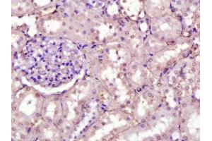 Paraformaldehyde-fixed, paraffin embedded rat kidney, Antigen retrieval by boiling in sodium citrate buffer (pH6) for 15min, Block endogenous peroxidase by 3% hydrogen peroxide for 30 minutes, Blocking buffer (normal serum) at 37°C for 20min, Antibody incubation with Fibronectin (1B9) Monoclonal Antibody  at 1:200 overnight at 4°C, followed by a conjugated secondary and DAB staining. (Fibronectin antibody  (AA 2240-2280))