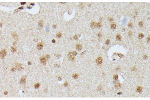 Immunohistochemistry of paraffin-embedded Rat brain using IGHMBP2 Polyclonal Antibody at dilution of 1:100 (40x lens). (IGHMBP2 antibody)