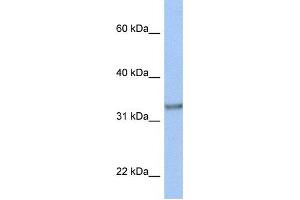 Western Blotting (WB) image for anti-Acyl-CoA Binding Domain Containing 4 (ACBD4) antibody (ABIN2459338)