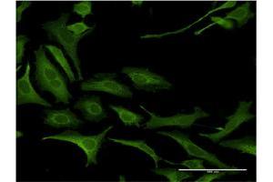 Immunofluorescence (IF) image for anti-Necdin Homolog (Mouse) (NDN) (AA 222-321) antibody (ABIN518219)