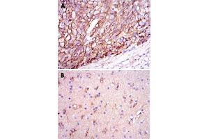 Immunohistochemical analysis of paraffin-embedded human liver cancer tissues (A) and brain tissues (B) using APOE monoclonal antibody, clone 1H4  with DAB staining.