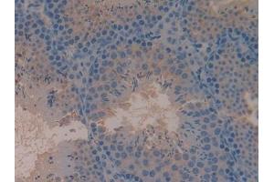 Immunohistochemistry (IHC) image for anti-Complement 4 (C4) (AA 1450-1723) antibody (ABIN7432859)