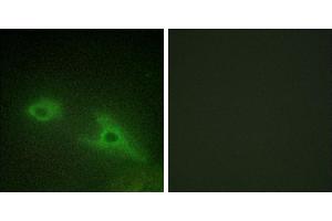 Peptide - +Western blot analysis of extracts from COLO205 cells, using EPHA1 antibody. (EPHA1 antibody  (Internal Region))