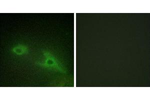 Peptide - +Western blot analysis of extracts from COLO205 cells, using EPHA1 antibody.