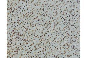 IHC analysis of RPA32/RPA2 using anti-RPA32/RPA2 antibody (ABIN7601379). (RPA2 antibody  (AA 34-254))