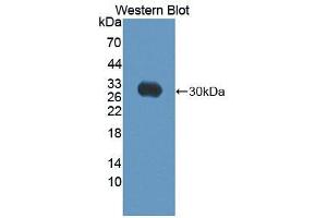 Figure. (ABCC10 antibody  (AA 1246-1492))