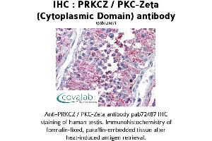 Image no. 2 for anti-Protein Kinase C, zeta (PRKCZ) (1st Cytoplasmic Domain) antibody (ABIN1738343) (PKC zeta antibody  (1st Cytoplasmic Domain))