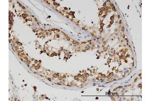 Image no. 2 for anti-Z-DNA Binding Protein 1 (ZBP1) (AA 2-101) antibody (ABIN599594) (ZBP1 antibody  (AA 2-101))
