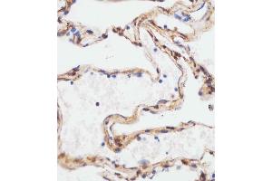 B staining TUBA4A in human lung tissue sections by Immunohistochemistry (IHC-P - paraformaldehyde-fixed, paraffin-embedded sections).