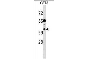 Western blot analysis in CEM cell line lysates (35ug/lane). (TSSC1 antibody  (C-Term))