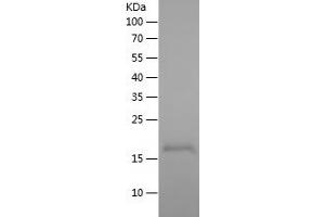 Western Blotting (WB) image for WAP Four-Disulfide Core Domain 3 (WFDC3) (AA 25-160) protein (His tag) (ABIN7282820) (WFDC3 Protein (AA 25-160) (His tag))