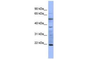 Image no. 1 for anti-Myosin, Light Chain 3 (MYL3) (AA 35-84) antibody (ABIN6741643) (MYL3/CMLC1 antibody  (AA 35-84))