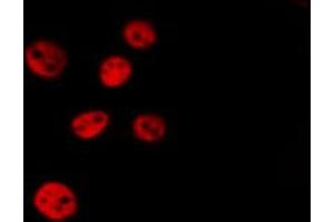 ABIN6267699 staining Hela by IF/ICC. (HDAC5 antibody  (pSer259))