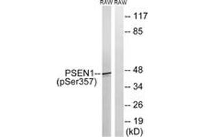 Western blot analysis of extracts from RAW264. (Presenilin 1 antibody  (pSer357))