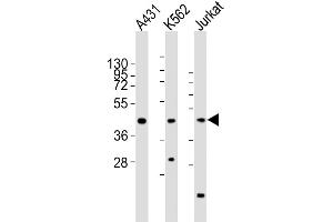 RBMX antibody  (AA 222-252)