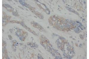 Immunohistochemistry (IHC) image for anti-Tubulin, alpha 1a (Tuba1a) antibody (ABIN1105303) (TUBA1A antibody)