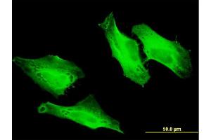 Immunofluorescence of monoclonal antibody to CEP57 on HeLa cell . (CEP57 antibody  (AA 19-128))