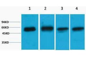 Western Blotting (WB) image for anti-V-Akt Murine Thymoma Viral Oncogene Homolog 3 (Protein Kinase B, Gamma) (AKT3) antibody (ABIN3178777) (AKT3 antibody)
