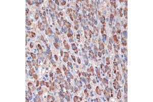 Immunohistochemistry of paraffin-embedded human liver using TIMM50 Rabbit mAb (ABIN1513120, ABIN3022092, ABIN3022093 and ABIN7101443) at dilution of 1:100 (40x lens). (TIMM50 antibody)