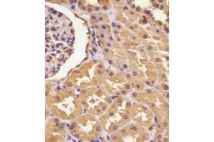 (ABIN390810 and ABIN2841047) staining ASS in human kidney tissue sections by Immunohistochemistry (IHC-P - paraformaldehyde-fixed, paraffin-embedded sections). (ASS1 antibody  (AA 192-221))