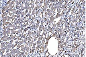 IHC analysis of GFPT1 using anti-GFPT1 antibody (ABIN7602887).