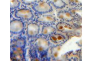 Used in DAB staining on fromalin fixed paraffin-embedded bowels tissue (KRT20 antibody  (AA 2-431))