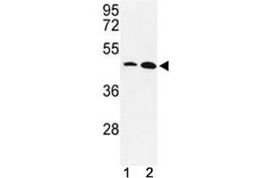Western blot analysis of KLF4 antibody and MDA-MB231, NCI-H460 lysate.