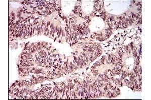 anti-Transducin (Beta)-Like 1 X-Linked Receptor 1 (TBL1XR1) antibody