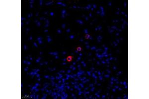 Immunofluorescence of paraffin embedded human colon using MADCAM1 (ABIN7074695) at dilution of 1:1800 (400x lens) (MADCAM1 antibody)