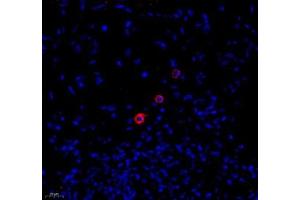 Immunofluorescence of paraffin embedded human colon using MADCAM1 (ABIN7074695) at dilution of 1:1800 (400x lens) (MADCAM1 antibody)