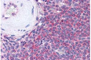 Human Spleen (formalin-fixed, paraffin-embedded) stained with THBS1 antibody ABIN305761 at 5 ug/ml followed by biotinylated anti-mouse IgG secondary antibody ABIN481714, alkaline phosphatase-streptavidin and chromogen. (Thrombospondin 1 antibody)