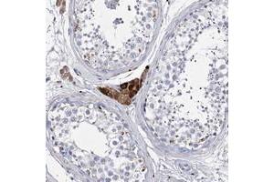 Immunohistochemical staining of human testis with SYNGAP1 polyclonal antibody  shows strong cytoplasmic positivity in Leydig cells.