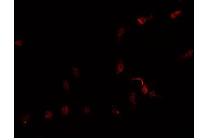ABIN6269259 staining Hep G2 cells by IF/ICC. (GATA4 antibody  (Internal Region))