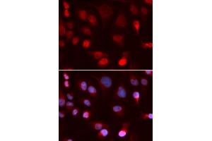 Immunofluorescence analysis of U2OS cells using ATP7B antibody (ABIN5973316). (ATP7B antibody)