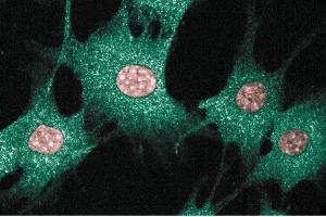 Immunofluorescence staining of BC3H1 cells (Mouse brain smooth muscle-like cells, ATCC CRL-1443). (BAX antibody  (AA 55-178))