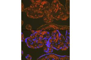 Immunofluorescence analysis of human placenta using PLGF Rabbit mAb (ABIN7269384) at dilution of 1:100 (40x lens). (PLGF antibody)